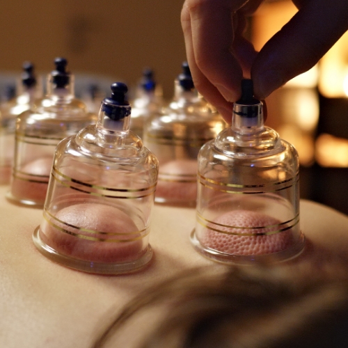 Trailhead-Physical-Therapy-and-Performance-Livingston-MT-cupping